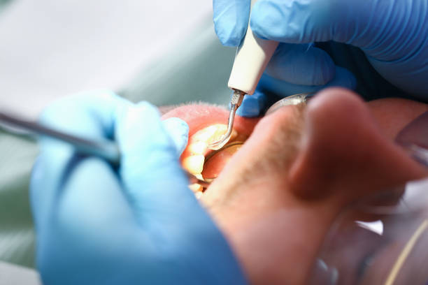 Best Same-Day Emergency Dentist in Ladd, IL