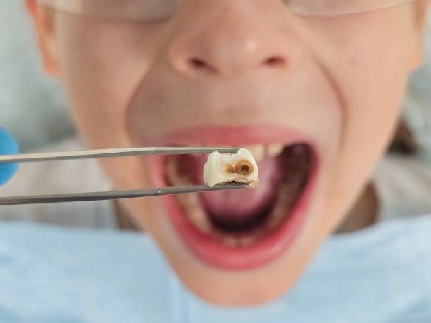 Best Emergency Dental Care for Trauma or Injury in Ladd, IL